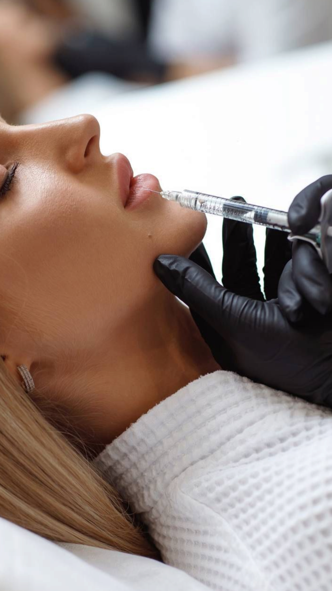 ტუჩის აუგმენტაცია — ესთეტიკური ბალანსი და ბუნებრივი შედეგი